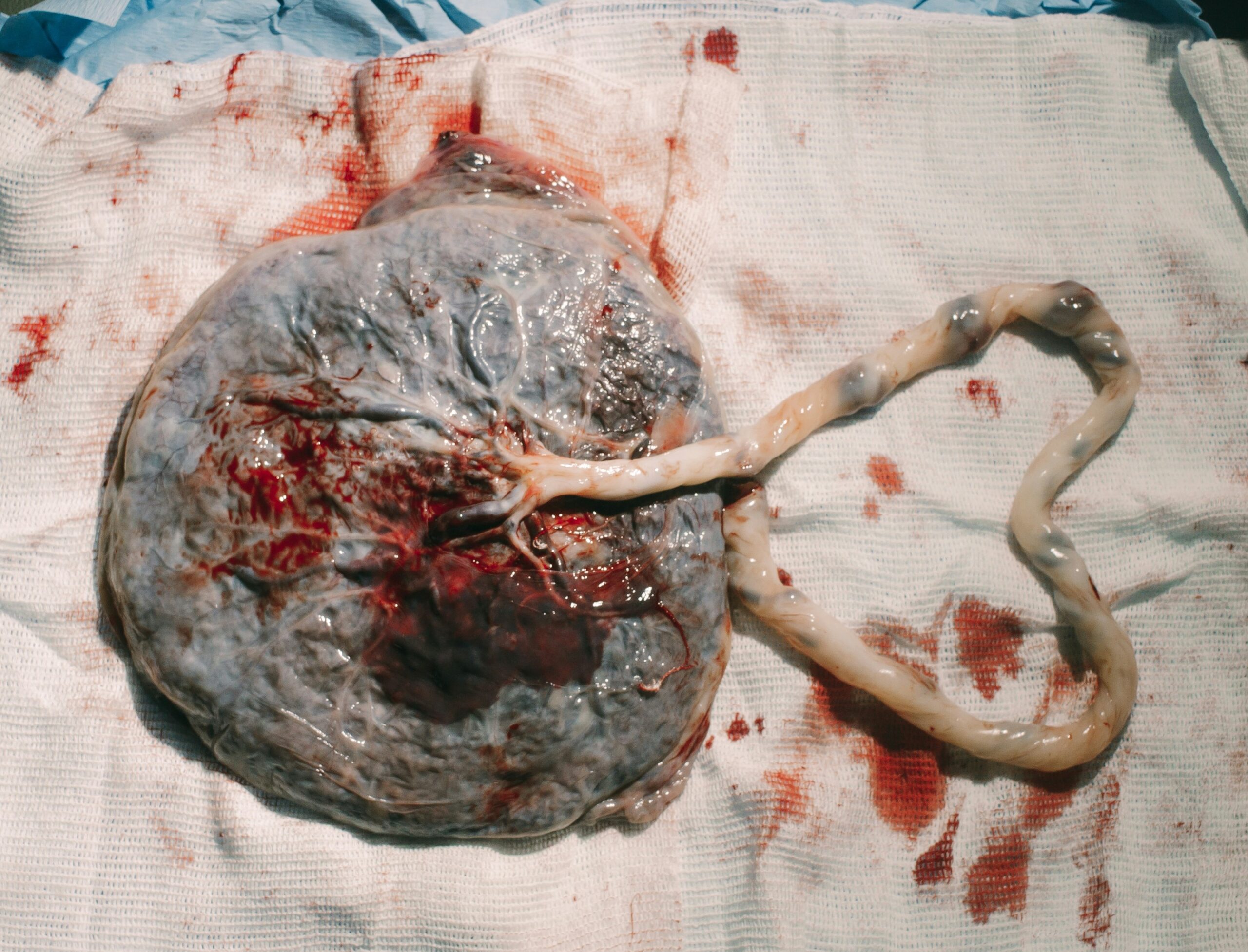 Le placenta : un organe fascinant à honorer